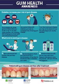 Diabetes and gum disease: information for patients