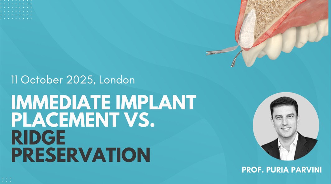 Immediate Implants vs Ridge Preservation