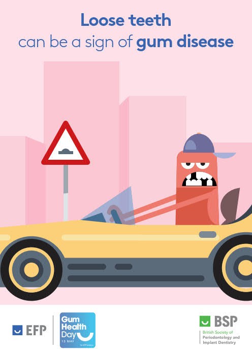 Loose teeth can be a sign of gum disease